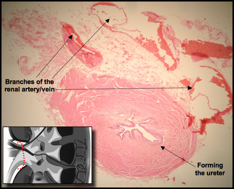 An image showing the Hilar Region of the kidney