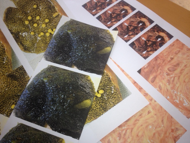 Printed examples of gallbladder mucosa